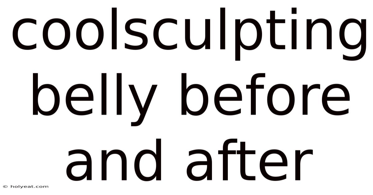 Coolsculpting Belly Before And After