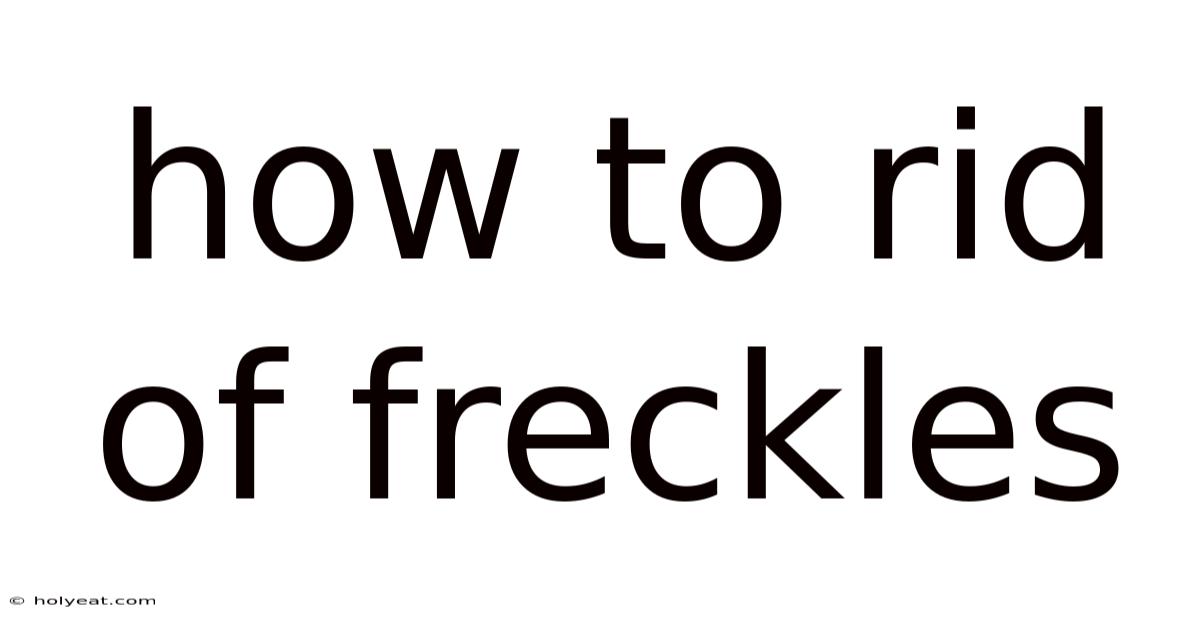 How To Rid Of Freckles